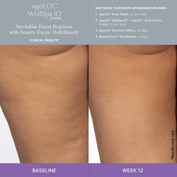 WellSpa iO System Revitalise Focus (Sverige) 3