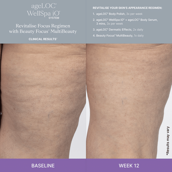 WellSpa iO System Revitalise Focus (Sverige) 4